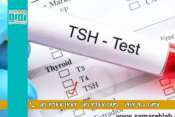 آزمایش TSH یا هورمورن محرک تیروئید چیست