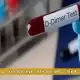 آزمایش D-dimer چیست و چه کاربردهایی دارد؟ آزمایش D-dimer چیست و چه کاربردهایی دارد