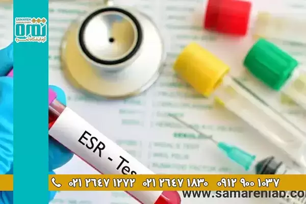 آزمایش ESR چیست و برای تشخیص چه بیماری هایی انجام می شود
