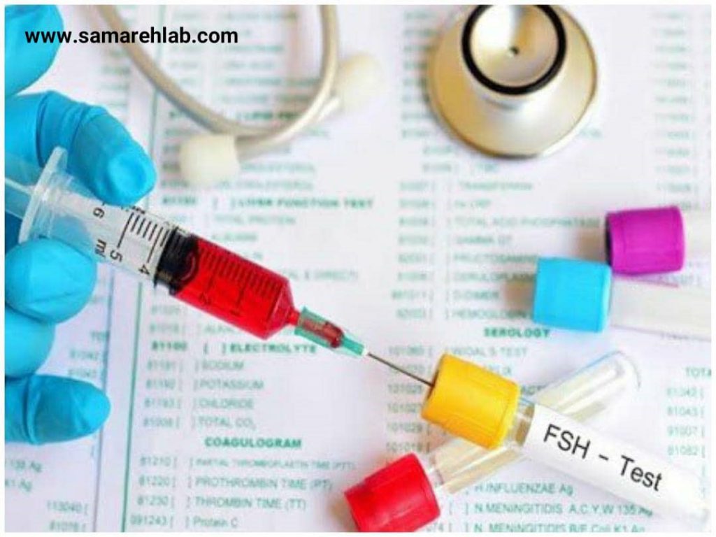 آزمایش FSH