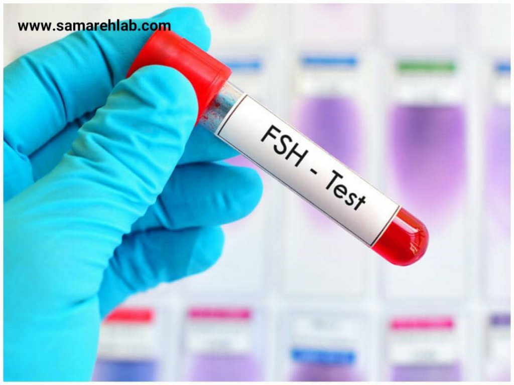 آزمایش FSH