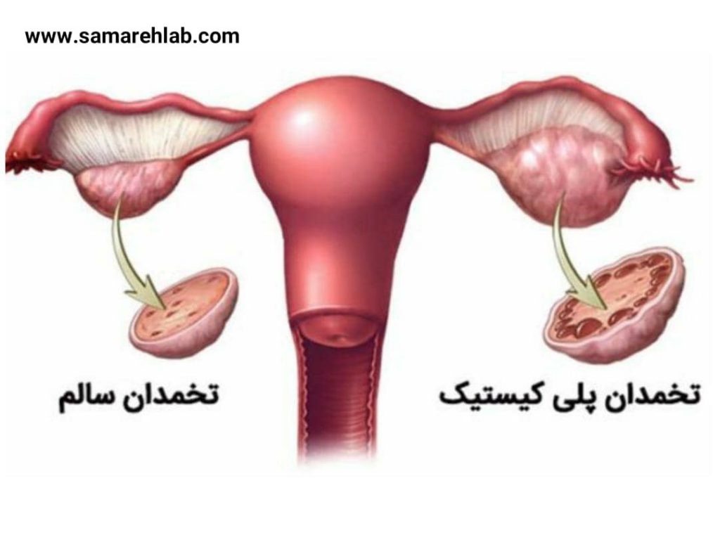 آزمایش FSH