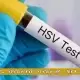 عفونت HSV چیست و چه علائمی دارد؟ عفونت HSV چیست و چه علائمی دارد