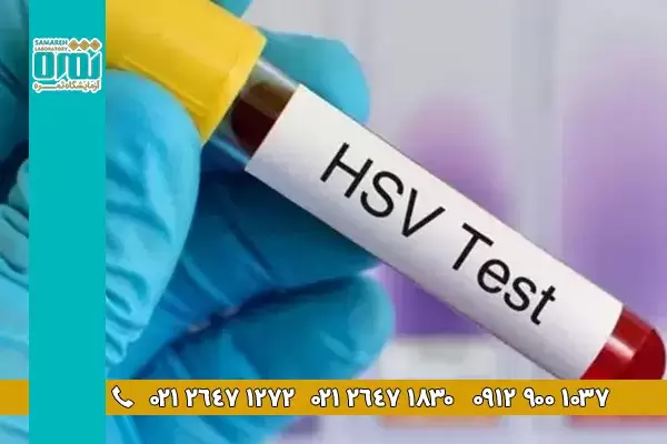 عفونت HSV چیست و چه علائمی دارد