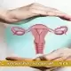 عفونت قارچی واژن چیست و چه علائمی دارد