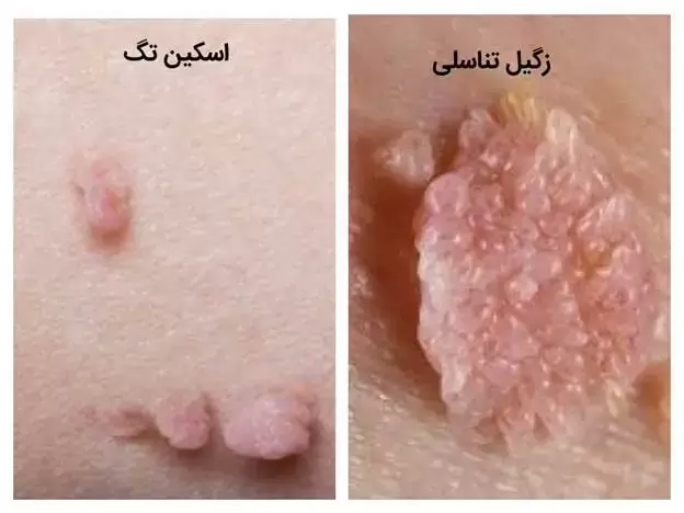 اسکین تگ