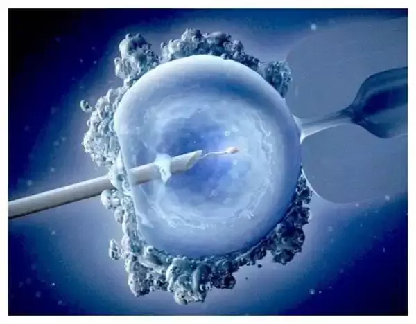 میکرواینجکشن یا تزریق اسپرم داخل تخمک درمان ناباروری