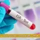 ESR چیست و در چه شرایطی تجویز می‌ شود