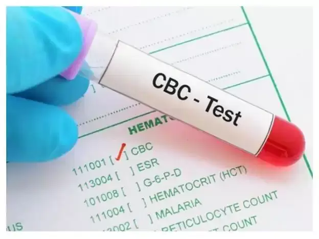 آزمایش cbc
