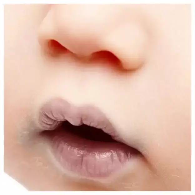 بیماری قلبی مادرزادی