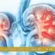 13 مورد از بیماریهای کلیوی شایع ,علائم و درمان آنها بیماریهای کلیوی شایع