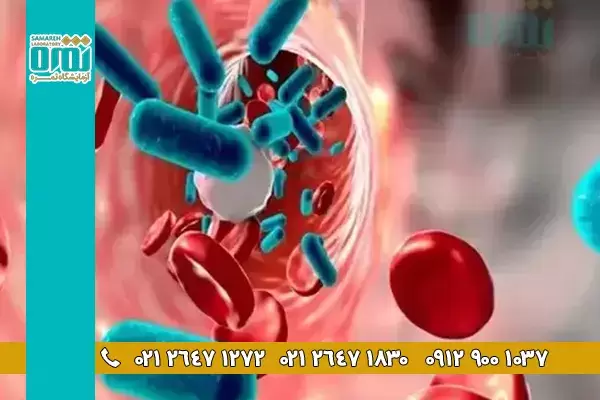 13 نوع از بیماری های باکتریایی که با آزمایش خون مشخص می شوند