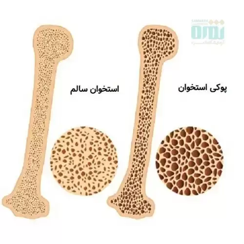 آزمایش PTH