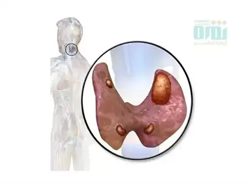 آزمایش PTH