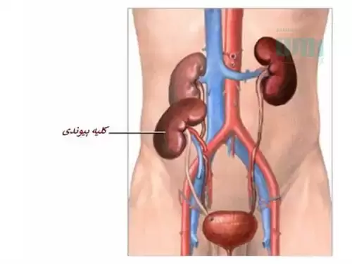 بیماریهای کلیوی
