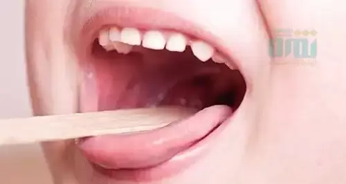عفونت گوش، حلق و بینی