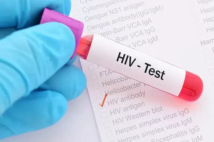 تست HIV ایدز