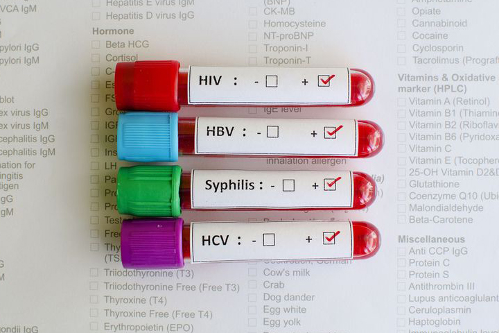 تست‌های تشخیص بیماری‌های مقاربتی (STD) + راه درمان آن‌ها: نگاهی تخصصی به خدمات آزمایشگاه ثمره