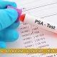 آزمایش PSA راهنمای کامل تست پروستات، تفسیر نتایج و هزینه (4)