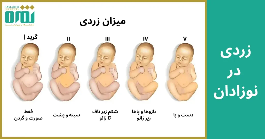 تست زردی نوزاد در منزل؛ ساده، سریع و بی‌دردسر!