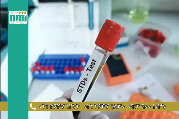 بیماریهای مقاربتی چه آزمایشی دارد و چه زمانی باید انجام شود؟ | راهنمای جامع تستهای STD بیماریهای مقاربتی چه آزمایشی دارد و چه زمانی باید انجام شود؟ | راهنمای جامع تستهای STD