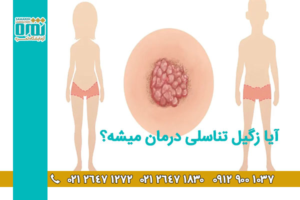 آزمایش HPV چیست و چگونه انجام میشود؟