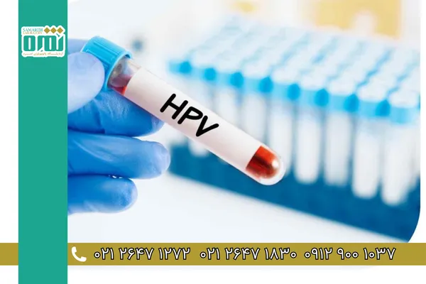 آزمایش HPV چیست و چگونه انجام میشود؟ آزمایش HPV